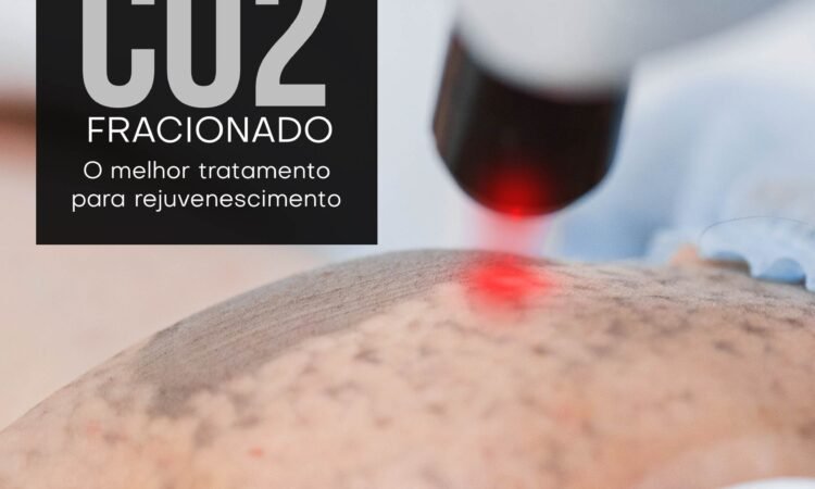 imagem não encontrada